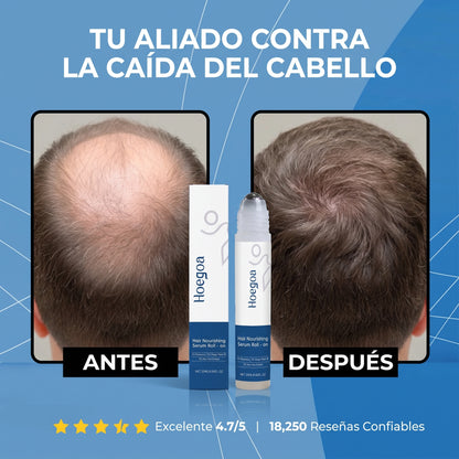 Hoegoa Hair Growth Roll on Serum